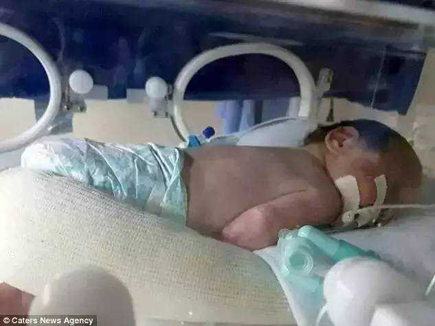 医院回应双胞胎儿生产死亡事件，生命的脆弱与医疗责任的反思
