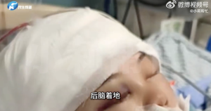 鲨鱼夹
