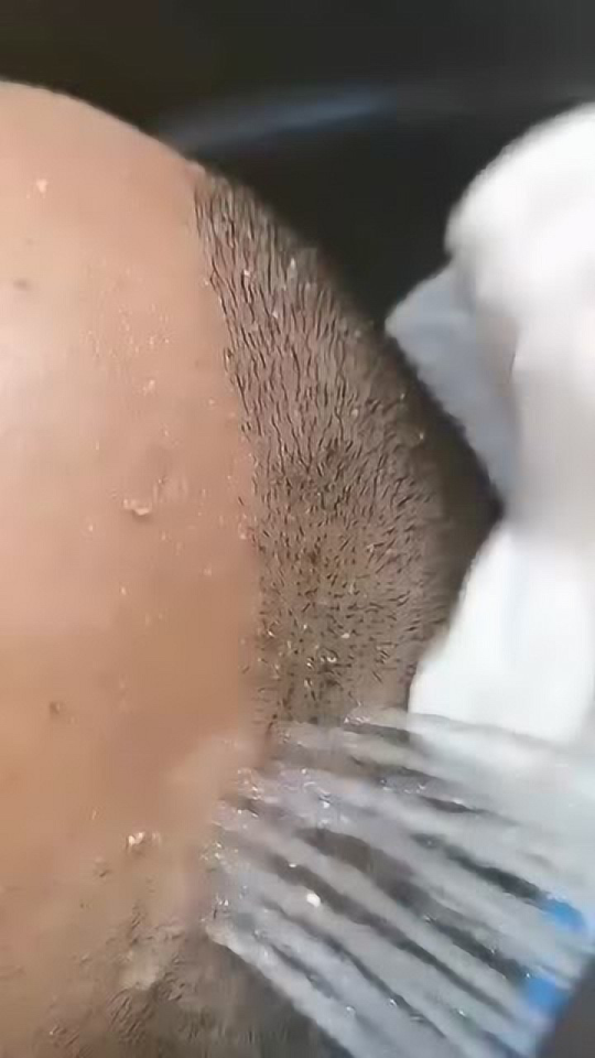 毛囊克隆技术前沿动态，科技重塑生活，引领未来毛囊克隆新篇章