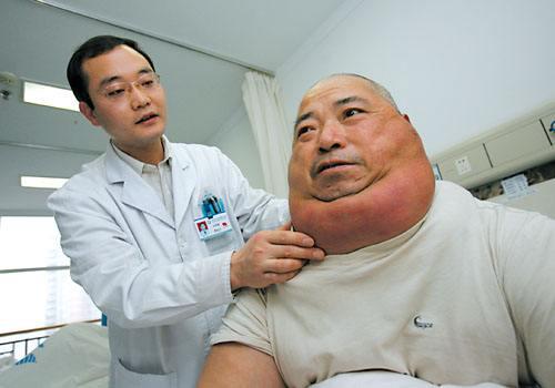 多发性脂肪瘤最新研究，科技引领健康之路，重塑生活新篇章