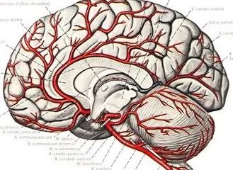 血管堵塞最新治疗技术与方法研究