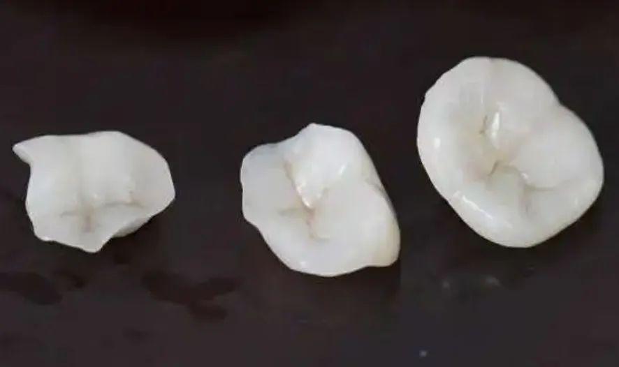 最新补牙材料，小巷中的隐秘宝藏探索