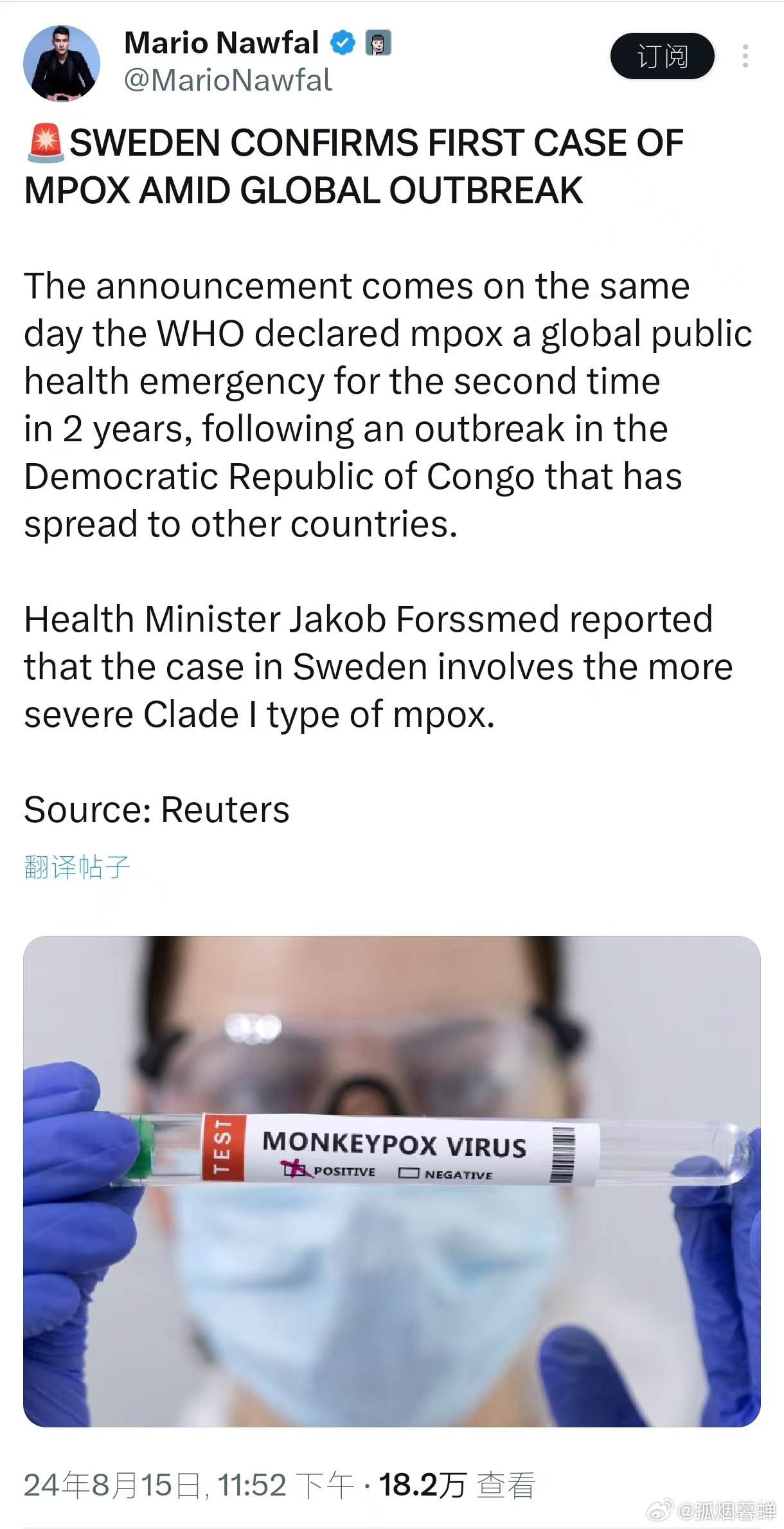 瑞典疫情最新动态更新